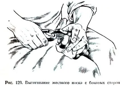 Затягане на лигавицата и трудно палеца