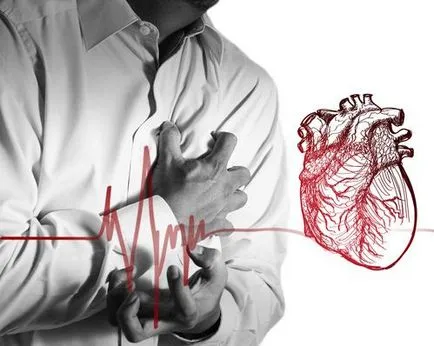 Összeesküvések varangyok (angina) és egyéb szívbetegségek, info-bázis