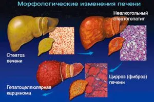 piele Râios a corpului pentru cauze hepatice si tratament