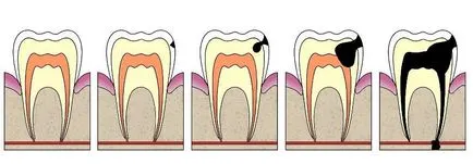 Durere de dinți în timpul alăptării decât vindecarea și ce să facă