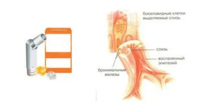 Bioparoks cu sinuzită cum să se aplice, declarația