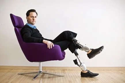 picior bionic proteză montator „originale“ (3 fotografii video)