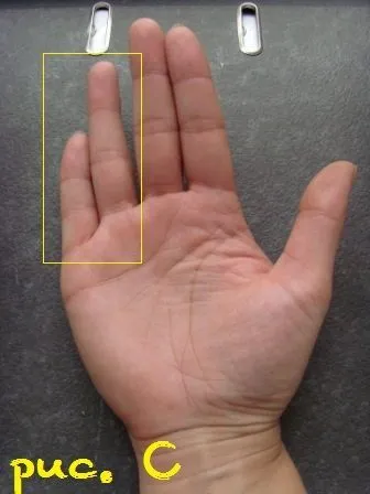 degetul pe gât mâna stângă, tratamentul durerii si simptome ale bolii pe EUROLAB, in al noualea cer