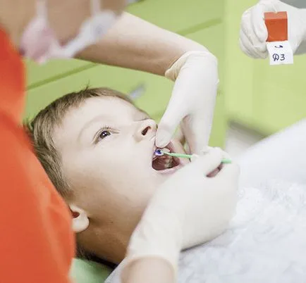 Миенето на зъбите при деца и юноши, професионална укрепване и флуорирането на млечни зъби