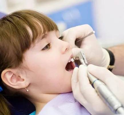 Миенето на зъбите при деца и юноши, професионална укрепване и флуорирането на млечни зъби