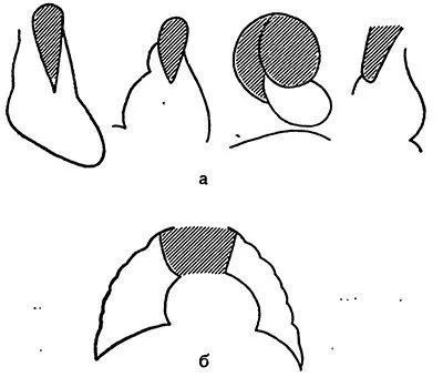 Betegségek diagnosztizálására thymus (csecsemőmirigy) mirigy