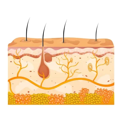 Dermatologie în Israel, tratamentul pielii cu metode moderne