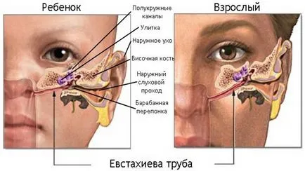 Двустранно отит в детето и възрастни