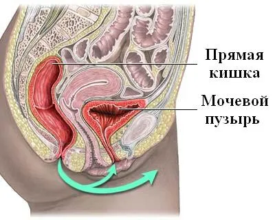 húgyúti fertőzés felnőtteknél okozza a fő kórokozói húgyúti fertőzések