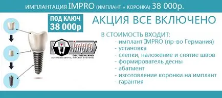 Имплантирането на всички по четири или всички на 4 цена в София протези на имплантанти на всички