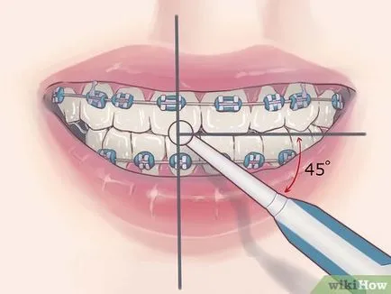 Как да се използва електрическа четка за зъби с тиранти