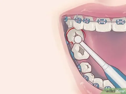 Как да се използва електрическа четка за зъби с тиранти