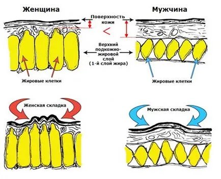 Как да се отървете от целулита част 1 от проблема - fitnesomaniya за всички!