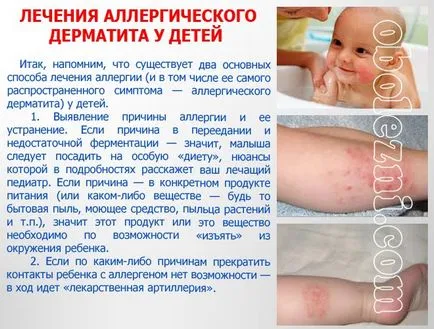 Az atópiás dermatitis gyermekeknél - egy fotót a betegség tüneteit