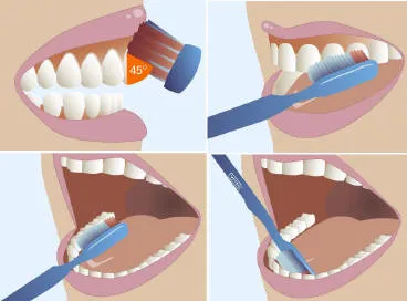 Hogyan gyógyítja a fogíny