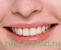 corectare contur gingival în protetica