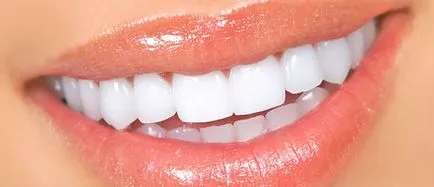 dinți scurte care fac stomatologie Vsevolozhsk Medotel