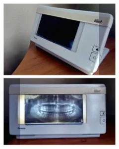 Рентгеново оборудване