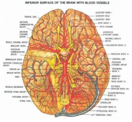 Tratamentul de accident vascular cerebral, utilizarea nootropics