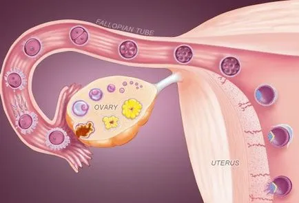 Tratamentul Infertilitate - Sol-Iletsk Centrul medical de reabilitare