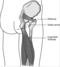 expert IRM, non-articulare localizarea durerii (sindromul Hamstring, ARS-sindrom)