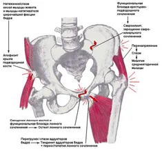 expert IRM, non-articulare localizarea durerii (sindromul Hamstring, ARS-sindrom)