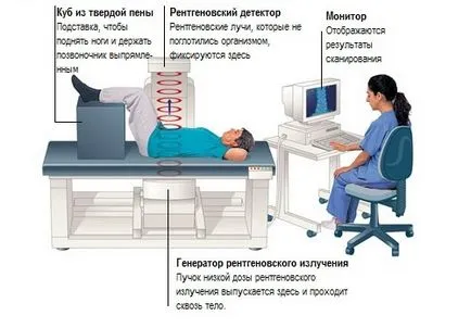 Caracteristici ale densitometrie pentru diagnosticarea osteoporozei