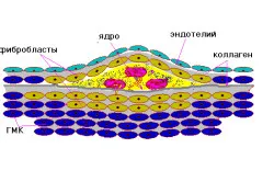 Az atherosclerosis