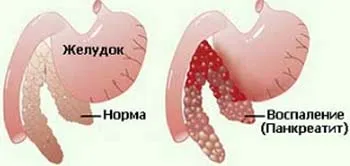 Hasnyálmirigy-gyulladás tünetei és kezelése macskák