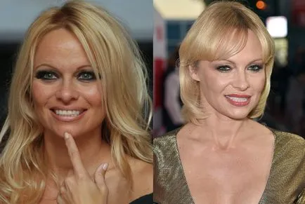 Pamela Anderson, inainte si dupa interventia chirurgicala (Fotografii) - 300