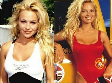 Pamela Anderson, inainte si dupa interventia chirurgicala (Fotografii) - 300