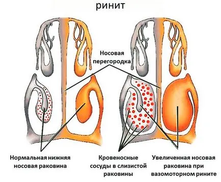 Защо подвижна течност сополи