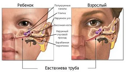 Причините за възпаление на средното ухо при деца как да се избегне рецидив