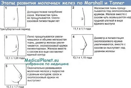 Преждевременно растежа на гърдата и на пубиса