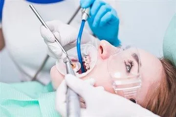 Procesul de instalare a acolade - pregătirea, elemente de prindere pe senzație de dinți în timpul și după