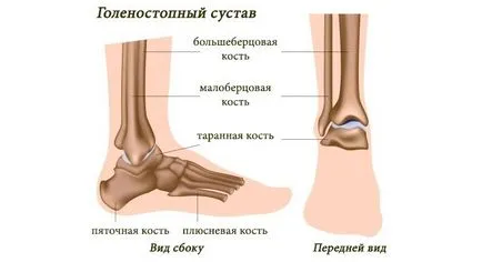 Симптоми и лечение на глезена фрактура (снимка)