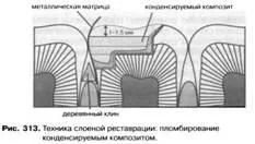 пластове техника възстановяване