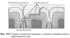 пластове техника възстановяване