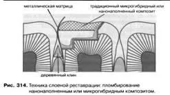 пластове техника възстановяване