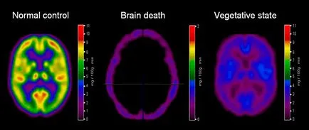 Учените са установили, какво се случва с човешкия мозък след смъртта