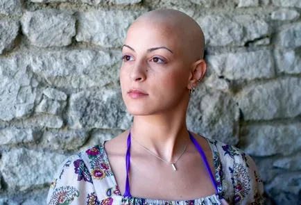 Caderea parului dupa chimioterapie, de ce se întâmplă și ce să facă