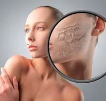Mit lehet tenni azzal a kifejezett kiszáradás a bőr, és hogyan megelőzés ér folytat