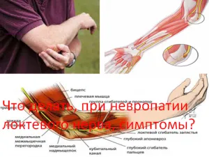 Ce trebuie să fac atunci când neuropatia nervului ulnar, simptome, medicul meu vrăjitoare