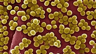 Ce este Staphylococcus informații importante