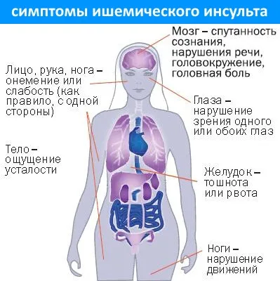 Възстановяване от исхемичен инсулт - физиотерапия у дома