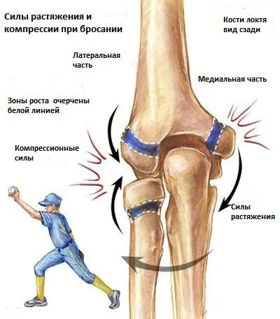 Крекинг в процеса на лакът податлив на лечение