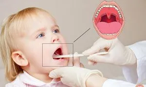 Hogyan kezelik a gyermek nyakára nagyon vörös