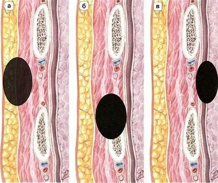 Diagnosticul tumorilor maligne primare ale peretelui toracic