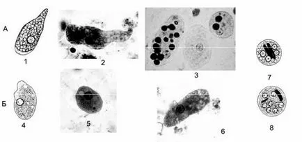 Entamoeba histolytica (Entamoeba histolytica)