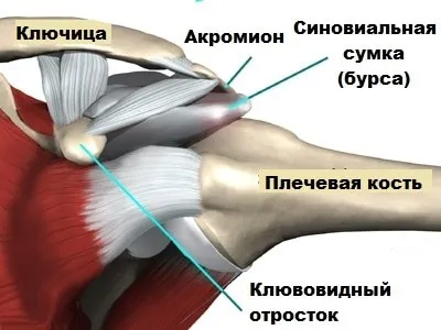 Sindromul impingement de sindromul articulației umărului drept